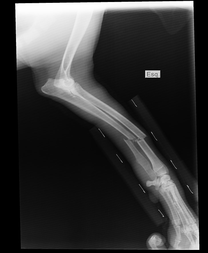 bruten arm, x-ray, Shin, engelska pointer, röntgenbilden