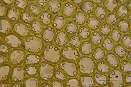 bazzania tricrenata, mikroskopiske, celler, biologi, makro, vitenskap, anlegget