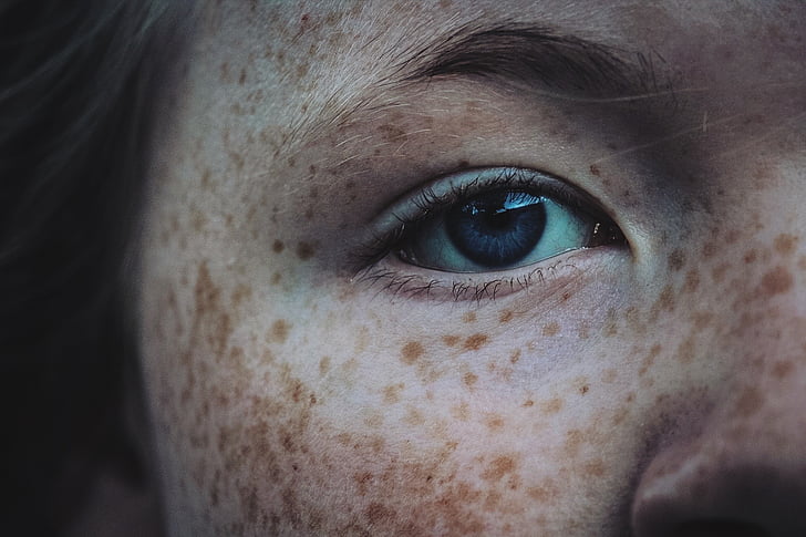face, eye, girl, freckles, portrait, close-up, people