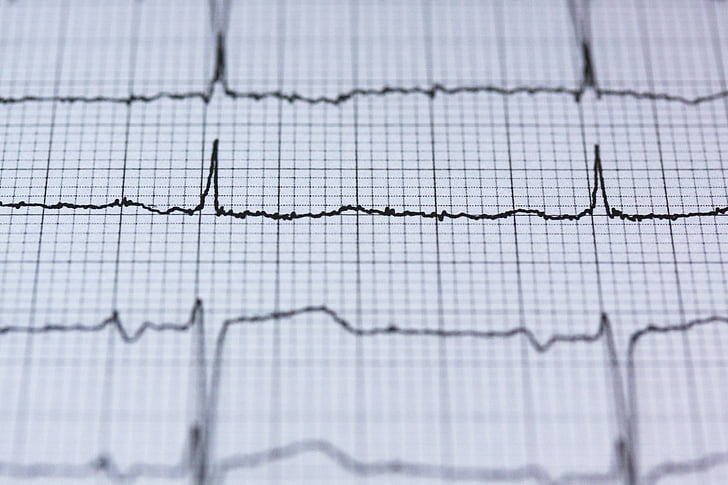 ECG :, électrocardiogramme, Medical, battement de coeur, coeur, fréquence, courbe de
