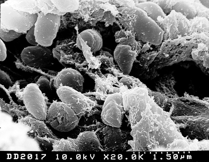 pestis, bacterias, peste bubónica, microscopio electrónico de, exploración, microscópicos, enfermedad