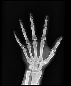 x-zraka, zdravlje, ruku, Liječnici, lijek, kosti, bolnica