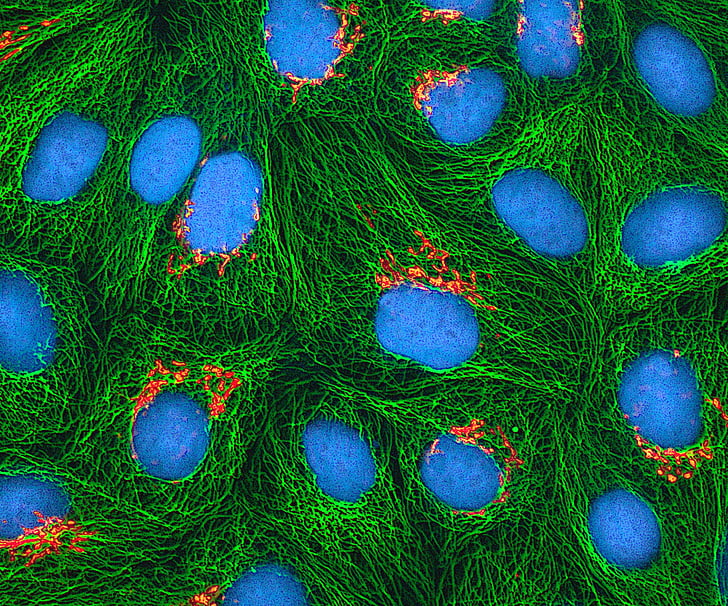 células HeLa, cultivadas, microscópio eletrônico, manchado, proteína fluorescente, microtúbulos