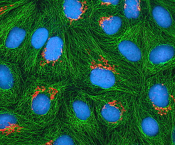 HeLa-Zellen, kultiviert, Elektronenmikroskop, befleckt, fluoreszierendes protein, Mikrotubuli