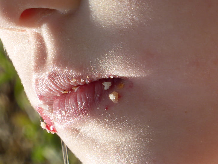 crumb, mouth, child, child's mouth, skin, face, human