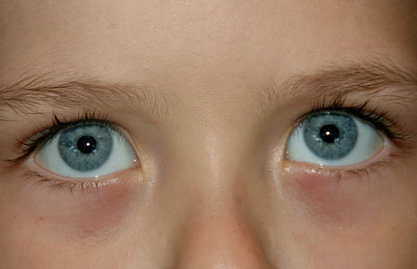 olho, azul, Gene