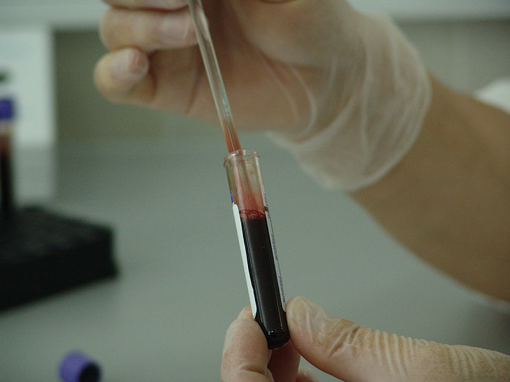 sangue, tubo de ensaio, análise, laboratório, teste, médica, medicina