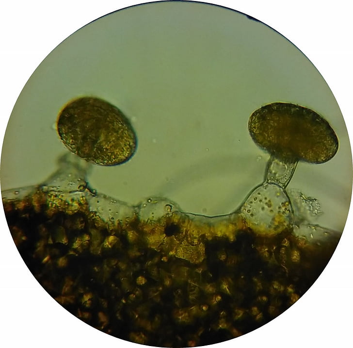 glàndules sebàcies loosestrife, cèl·lules glandulars, frontera amb flor del gènere Lythrum, loosestrife, glàndules sebàcies, imatge de microscopi, cèl·lules vegetals