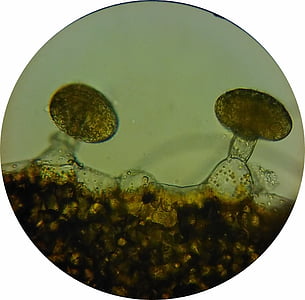 olio ghiandole lisimachia, cellule ghiandolari, bordo del fiore lisimachia, Salcerella, ghiandole di olio, immagine al microscopio, cellule vegetali