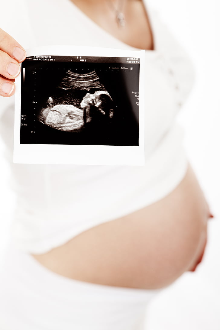 bebé, vientre, cuerpo, niño, esperan un bebé, mujer, salud