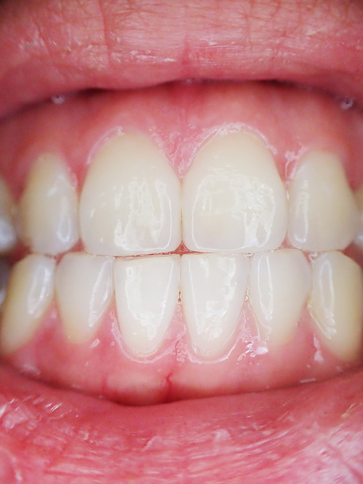 dientes, boca, dental, dentista, diente, labios, oral