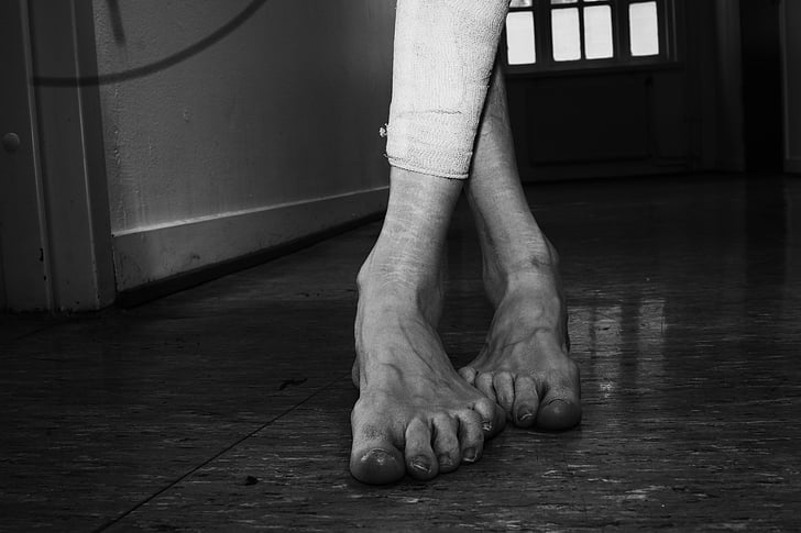 feet, legs, woman, human, scars, depression, self harming