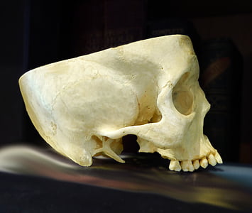 skalle, anatomi, kranium