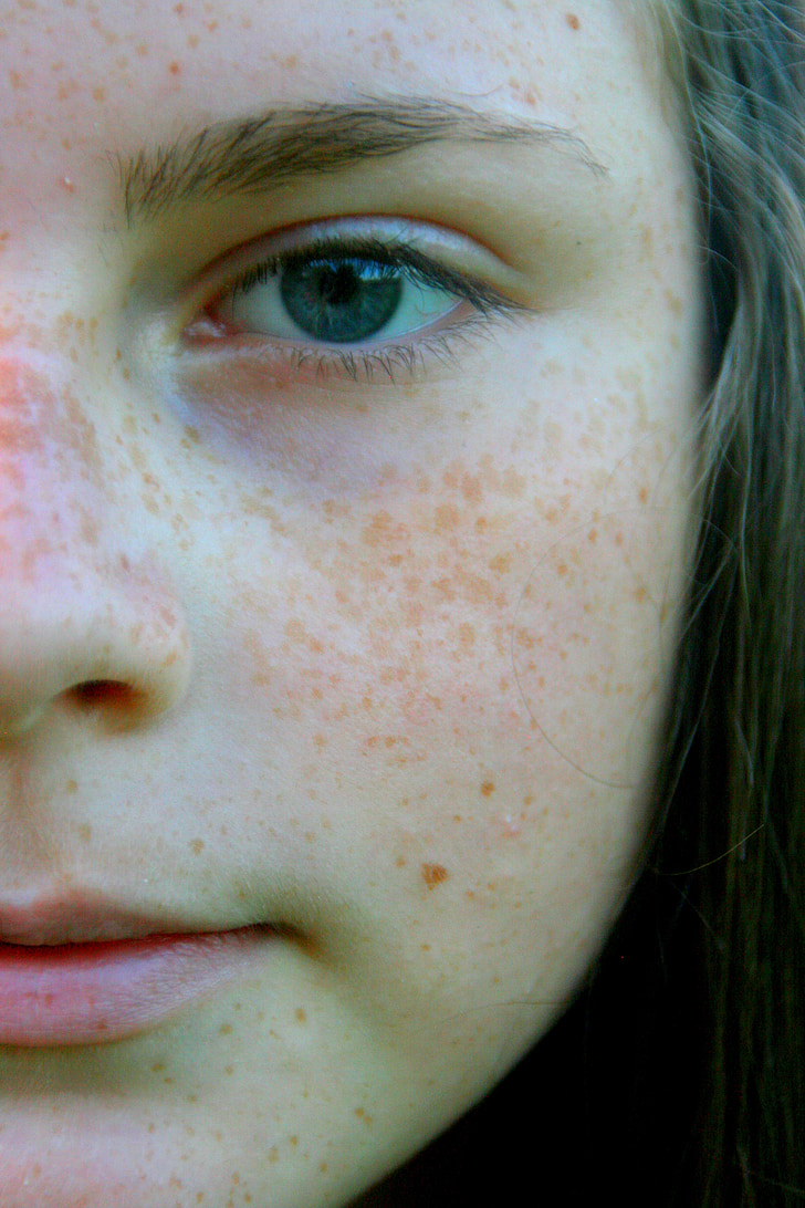 freckle face, portrait, blue eyes