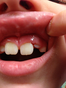 dientes, boca, dental