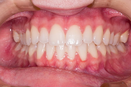 zuby, úsměv, zubař, lidské zuby, lidské rty, lidská ústa, část lidského těla