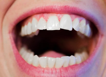 tanden, tandarts, Dental, mond, wit, hygiëne, tandheelkunde