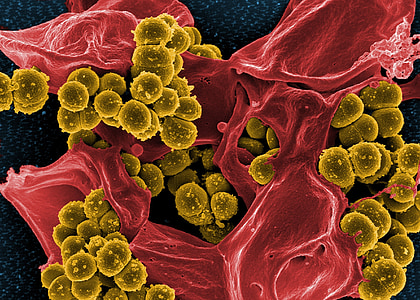 bactérias, microscópio eletrônico, manchado, verde, Staphylococcus aureus, esferoide, resistente à meticilina