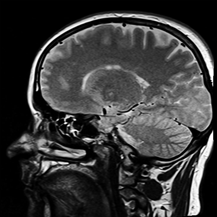 Kopf, Magnet-Resonanz-Tomographie, MRT, X-ray, X-Ray Bild, Gehirn