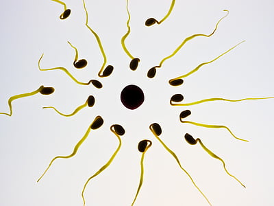 Sperma, Ei, Befruchtung, Sex-Zelle, Gewinner, Wettbewerb, Sperma
