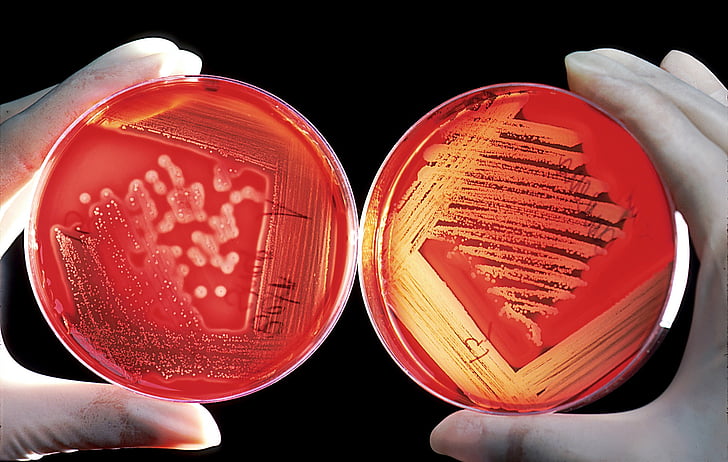agar, avl bakken, rød, blod celler, eksperimentet, forskning, agar agar