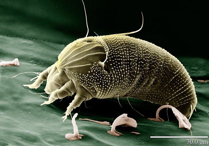 acaro, Aceria anthocoptes, acari, aracnide, ragno, microscopio elettronico, Eriophyidae