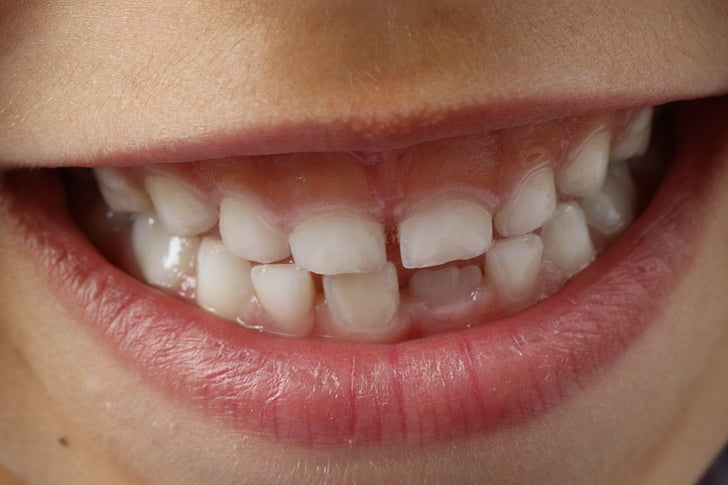 tænder, barn smil, barn, Dental, smil tænder, tand, hygiejne
