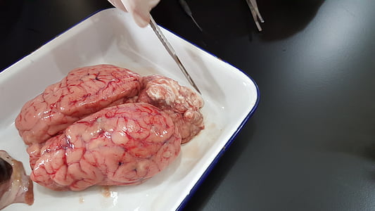 cérebro, órgão, experimento, laboratório
