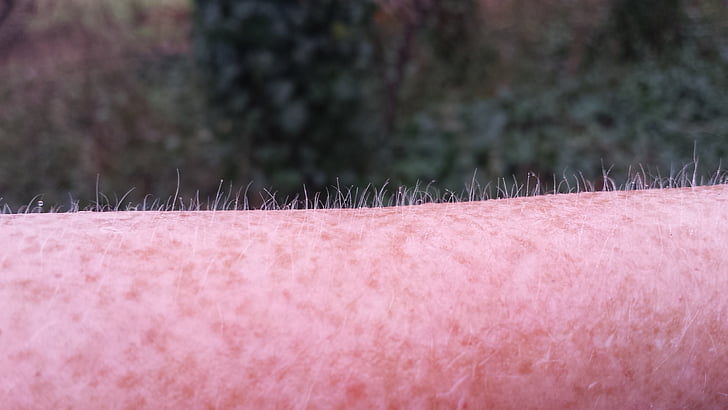 goose bumps, freckles, cold, pink color, close-up, no people, day
