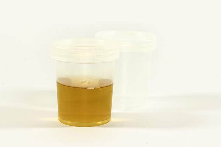 testen, urin container, urin, betennelse, analyse, medisinsk, laboratoriet