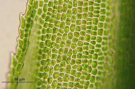Bartramia pomiformis, células, Biologia, miscroscopy, planta, Flora, ciência
