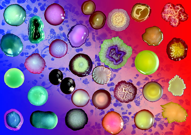 bactéries, colonies, coloration de Gram