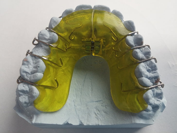 Zahnspangen, Zahnarzt, Kieferorthopädie, Dental-Schiene, Schienen, Zahn, Dental-Klammer