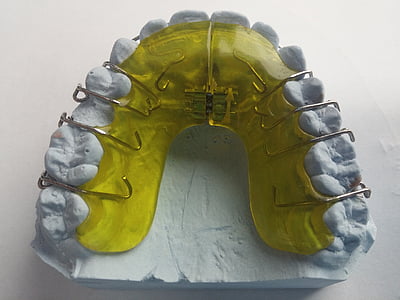 牙齿矫正, 牙医, 畸, 牙科栏杆, 似乎, 牙齿, 牙科支架