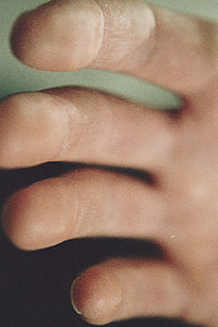 mà, pell, close-up, dits, grunge, adherència, copsar