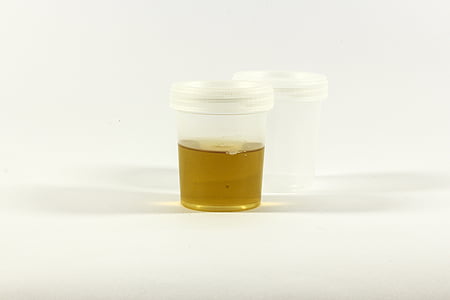 de test, urine container, urine, ontsteking, analyse, medische, laboratorium