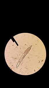 demodex, microscopi, àcar de la pell, moneda, moneda