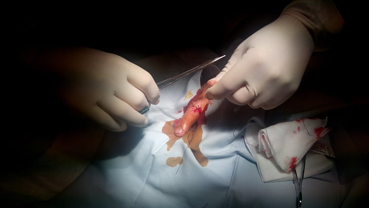 suture, wound, finger, hand, medicine, surgery