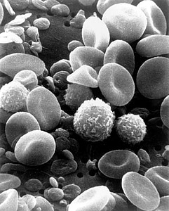 krevní buňky, buňky, lidské, elektronový mikroskop, skenování, krev, mikroskopické