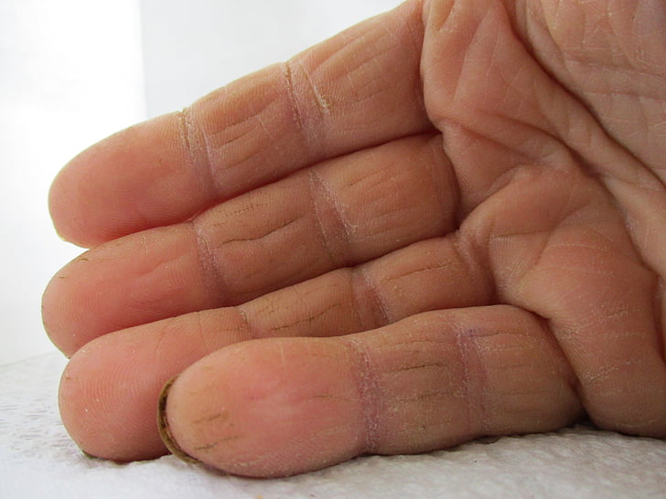 hand, handen, mensen, vingers, huid, menselijke hand, Close-up
