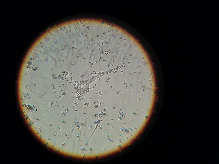 bakteri, mikroskop, mikroskopis gambar