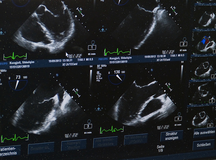 Ultrazvuk, x ray obrazu, nemocnica, lekár, lekárske, na zdravie, Kontrola zdravotného stavu