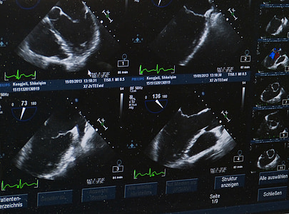 ultrazvuk, x ray slike, bolnica, Doktor, medicinski, nazdravlje, provjera stanja