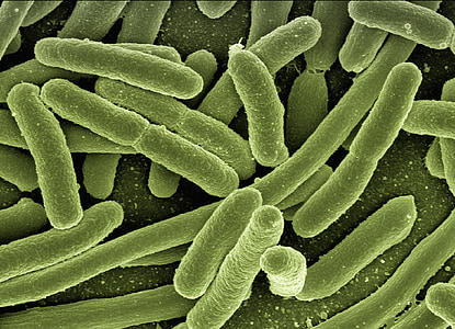 Koli-Bakterien, Escherichia coli, Bakterien, Krankheit, Krankheitserreger, Mikroskopie, Elektronenmikroskopie