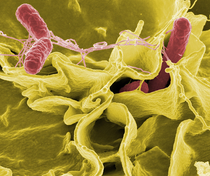 Salmonella, bactéries, macro, microscope électronique, Scan, microscopie, maladie