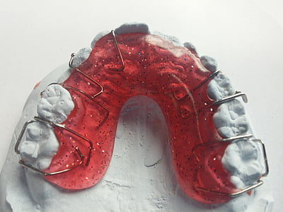 dokter gigi, ortodontik, rel gigi, tampak, kawat gigi, gigi, gigi penjepit