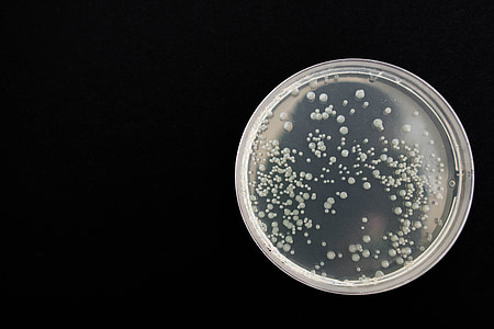 baktériumok, fekete, egészségügyi, Mikrobiológia, fertőzés, sejt, biológia