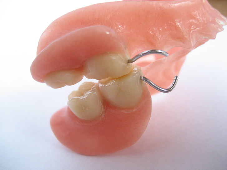 hampaat, hammas, ihmisen, Pine, lukko, kolmansien osapuolten