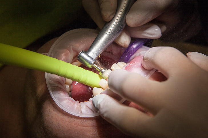 dentist, grind, facet, health, teeth, gloves, operation