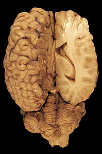 hjernen, anatomi, øyne, paerparat, hest, biologi, dorsal